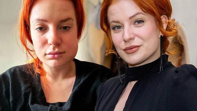 Kateřina Bláhová trpí obrovskými bolestmi: Po zánětu v zubu skončila v nemocnici, málem jí šlo o život