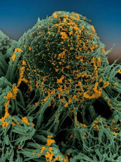 SARS-CoV-2, COVID-19 epidemic: the Institut Pasteur's response, scientific research and discoveries in 2020
