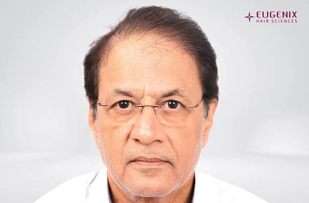 Arun Govil Front Before