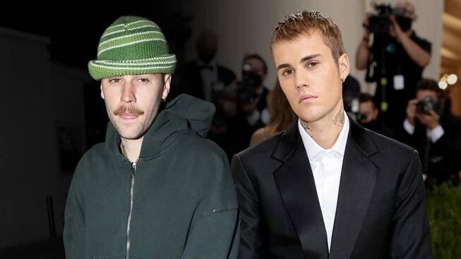 Justin Bieber přiznal, co stojí za jeho vyčerpaným vzhledem