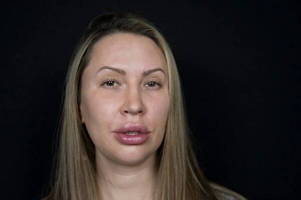 Od intimní operace po opuchlé rty: Odkopnutá žena ‚sexy trestance‘ vzala změnu vizáže od podlahy