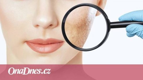 Sedm varovných příznaků kůže, které vás mohou upozornit na vážnou nemoc - iDNES.cz