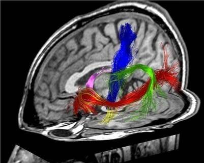 Neurochirurgická klinika UJEP a MNUL v Ústí nad Labem
