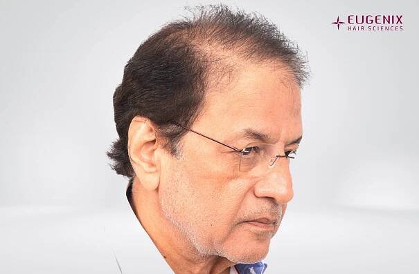 Arun Govil Left Before