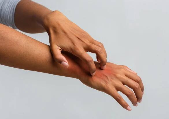 Ratgeber über Psoriasis Arthritis