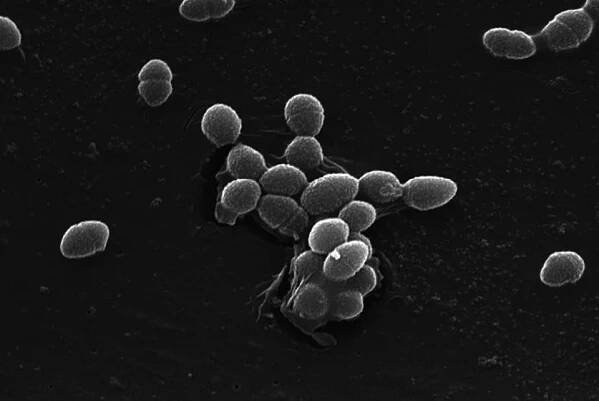 Enterococcus faecalis – Wikipedia