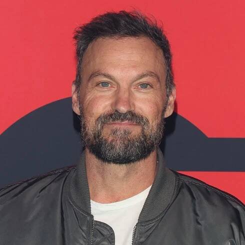 Brian Austin Green recovering after undergoing emergency surgery