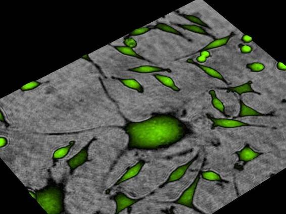 Huge L929 in green imaged and colored by the HoloMonitor software in green