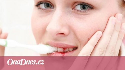 Krvácení dásní může přerůst v parodontitidu. Jak se mu vyhnout? - iDNES.cz