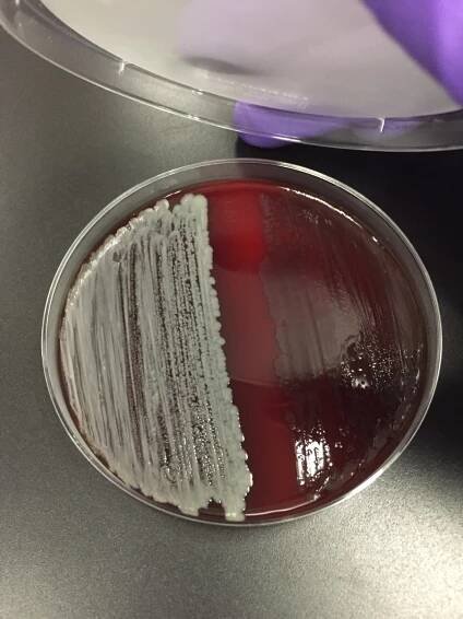 Corynebacterium spp. and B. polymyxa on SBA