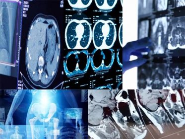New research suggests AI image generation using DALL-E 2 has promising future in radiology