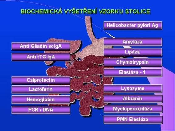 Vyšetření stolice – WikiSkripta
