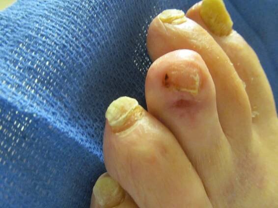 Show Your Toes