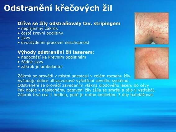 PPT - Laserové operace PowerPoint Presentation, free download - ID:5965196