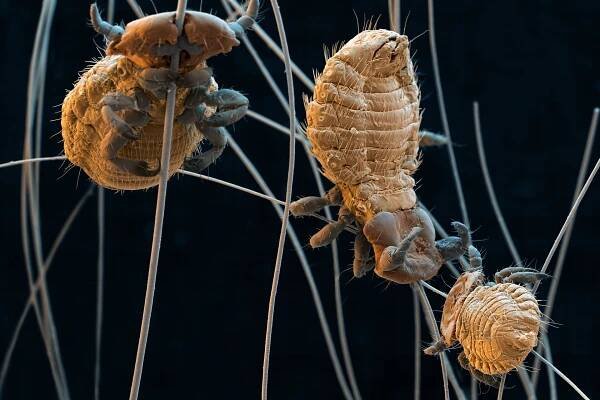 Our Microphotographs are often used in editorial reports and features - eye of science