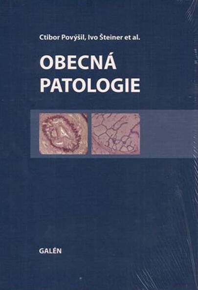 Obecná patologie