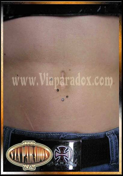 Microdermal - Via Paradox