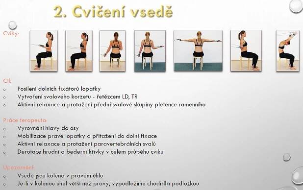 Skolióza - léčba v krocích | CD pro terapeuty | Eureko - skladem | Eureko 