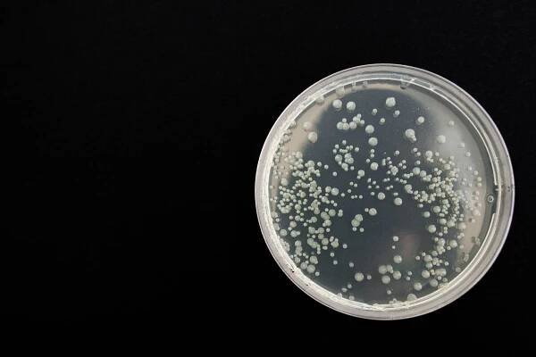 Průlom v boji s rezistentními bakteriemi: Vědci na MIT využívají umělou inteligenci k vývoji nového antibiotika Aubacin