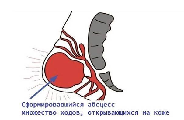 Лечение колита в Ростове по выгодной цене - Doctor-Prof