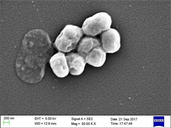 Acinetobacter baumannii charakteristiky, morfologie, metabolismus / Biologie