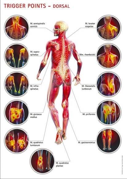 Massage Trigger Points