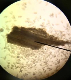 protists-microscope