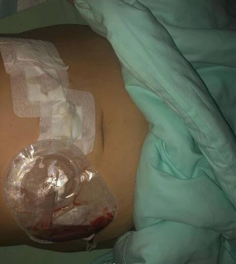 Zemřela Klára, která pomáhala, přestože sama trpěla. Smutná je i Ewa Farna
