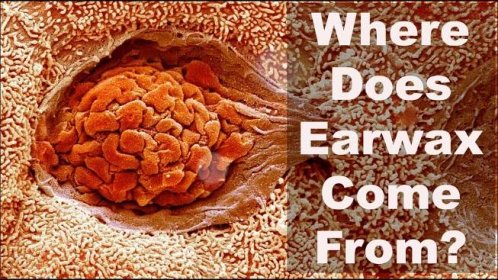 Where Does Earwax Come From?