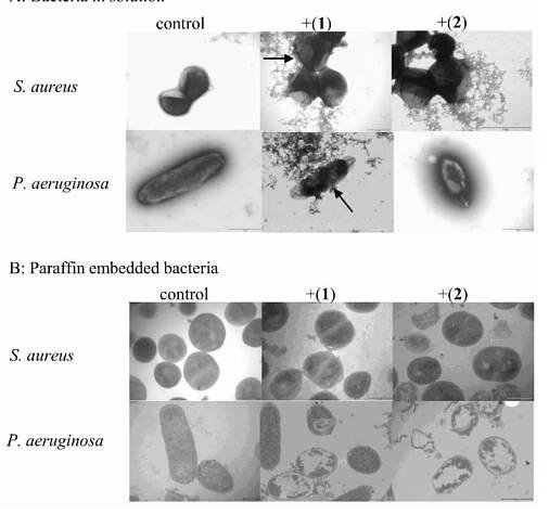 Figure 3. Changes in the cell morphology of S. aureus and P. aeruginosa cells treated with [CoCl(dap)2]CI- (1) and [CoCly(en)2]Cl- (2). Microscopic preparations prepared in solution and as paraffin-embedded bacteria. Transmission electron microscopy images of S. aureus ATCC 6538 and P. aeruginosa ATCC 9077 in the absence (control) and presence of Compounds (1) (+(1)) and (2) (+(2)). Magnification 20,000 x. 