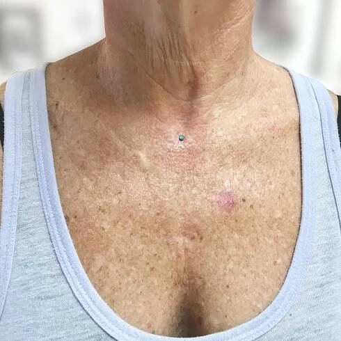 qohpiercing_microdermal_0012