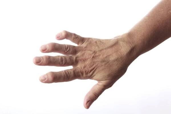 Nemoci kloubů vás »odepíší« na víc než 2 měsíce: