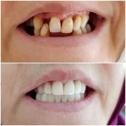 DENTAL TREATMENTS | North Health Group