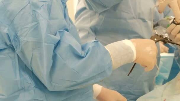 2019-01-25 Kostanay, Kazachstán. Laparoskopie v nemocnici. Closeup břišní chirurgie tlusté ženy. Tým profesionálních lékařů provádět endoskopii na břiše. Pohyb zleva doprava — Stock záběr