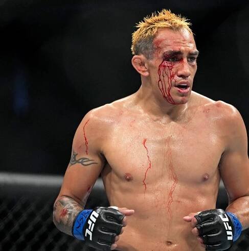 What’s Next For Tony Ferguson?