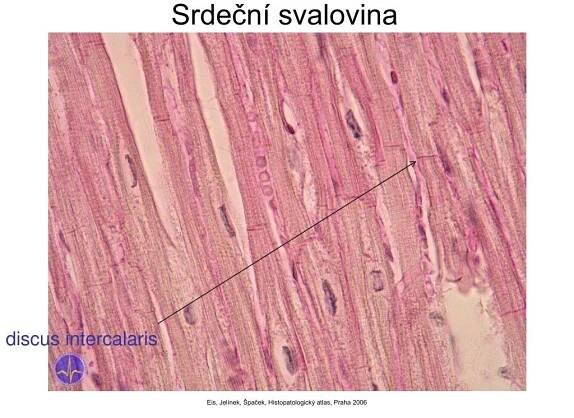PPT - Obecná myologie PowerPoint Presentation, free download - ID:5364547