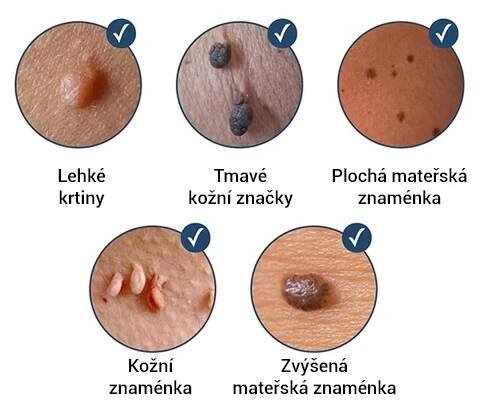 Náplasti na odstranění štítků 🌿🌿 – Melithea