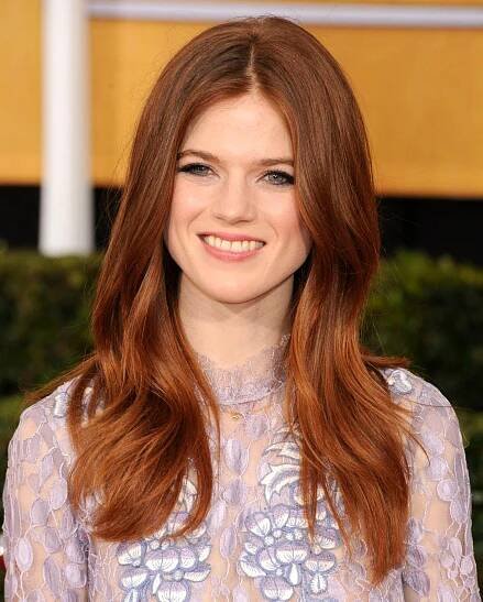 Rose Leslie – Clothing, Skin, Lip, Smile, Chin, Eyebrow, …