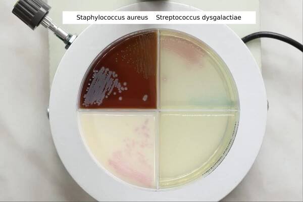 Staphylococcus aureus