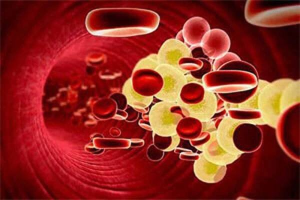 Symptomy a léčby hypercholesterolémie /