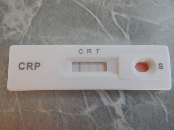 Zkušenosti domácí test CRP - Poradna pro ženy a dívky - WomenZone.cz 