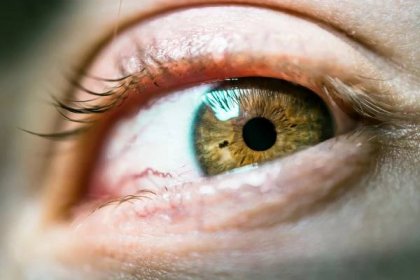 Za jak dlouho se zahojí prasklá žilka v oku?