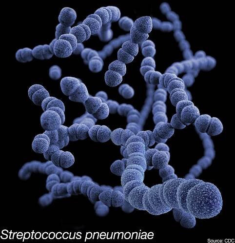Strings of purple balls of Streptococcus pyogenes bacteria.