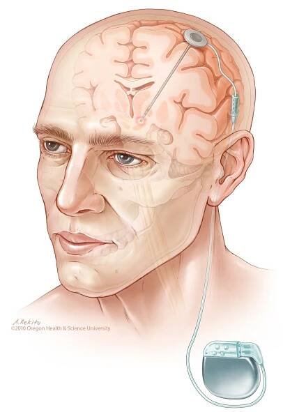 medical illustration neuroanatomy