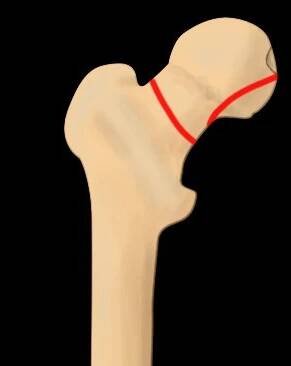 List of images | Classifications, online calculators, and tables in radiology