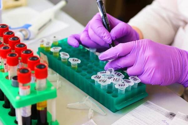 Tisíce Čechů vládnou superschopností – kvůli vyššímu bilirubinu v krvi