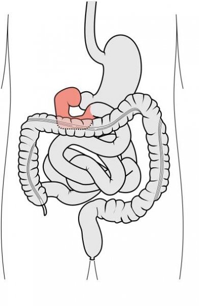 Soubor:Tractus intestinalis duodenum.svg – Wikipedie