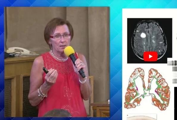 Ovlivňuje složení mikrobiomu vznik roztroušené sklerózy?