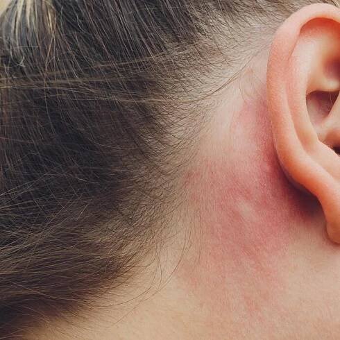 AD_IRRITATIONS_WOMAN-EAR_LARGE_2021