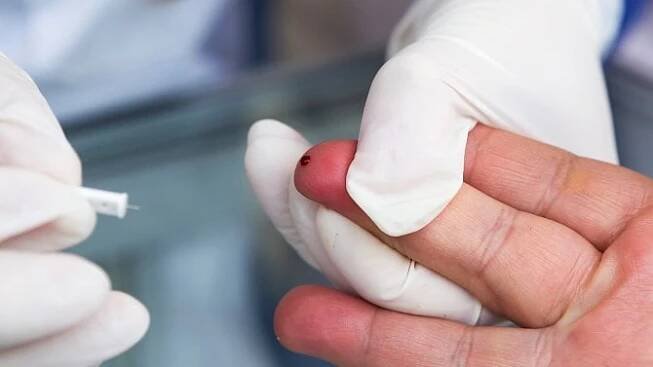 Základní vyšetření ledvin zahrnuje mimo jiné zjištění hladiny cukru v krvi